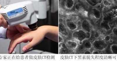 种植樱桃树需要注意的地方与施肥方法